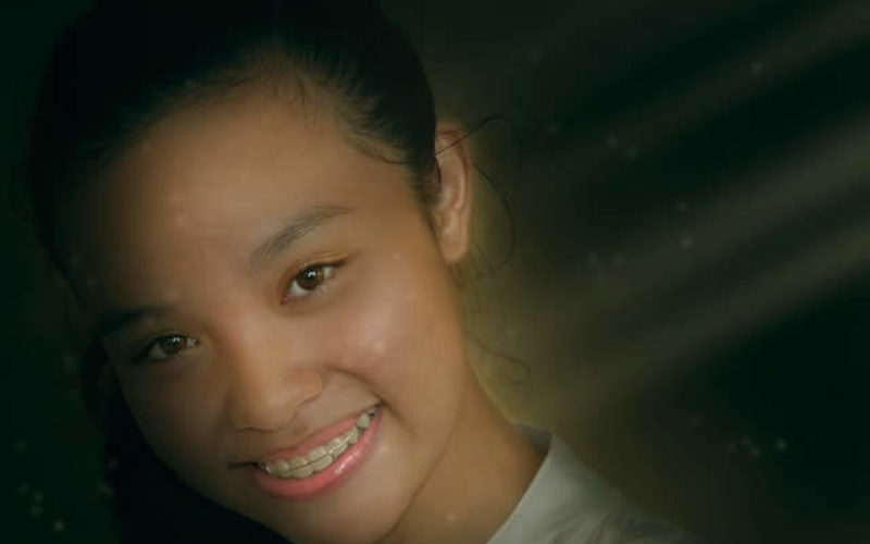 Why Children Need Braces Consultations?